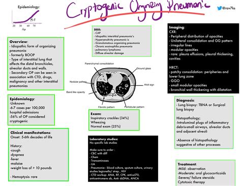 cryptogeen|Cryptogenic organising pneumonia: current understanding of an。